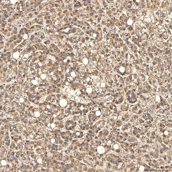 Syntenin 2/SDCBP2 Antibody