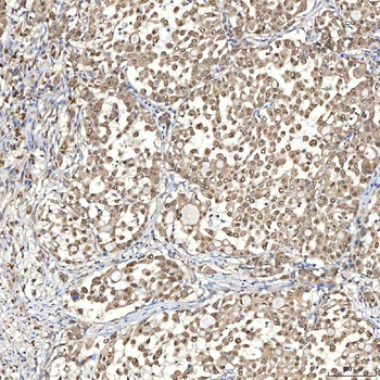 Syntenin 2/SDCBP2 Antibody