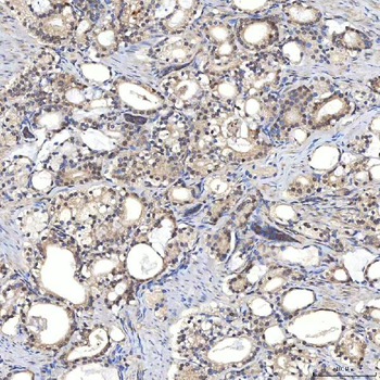 Syntenin 2/SDCBP2 Antibody