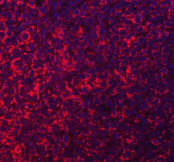 ACAD9 Rabbit Polyclonal Antibody