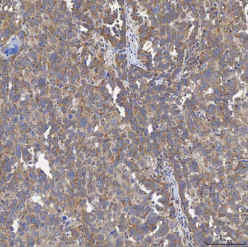 ACAD9 Rabbit Polyclonal Antibody