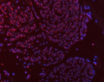 Thymidylate Synthase/TYMS Antibody