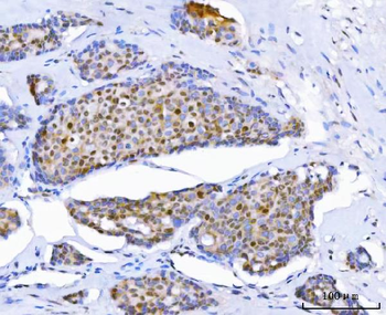 Thymidylate Synthase/TYMS Antibody