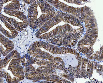 Thymidylate Synthase/TYMS Antibody