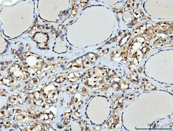 TTLL12 Rabbit Polyclonal Antibody