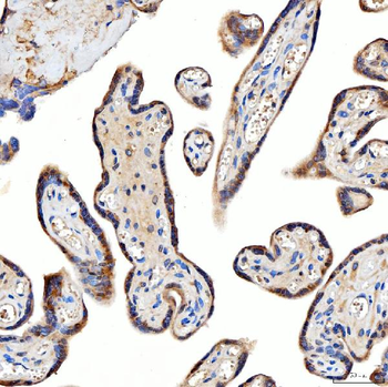 TTLL2 Antibody