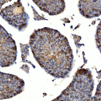 TTLL2 Antibody