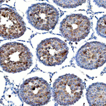 TTLL2 Antibody