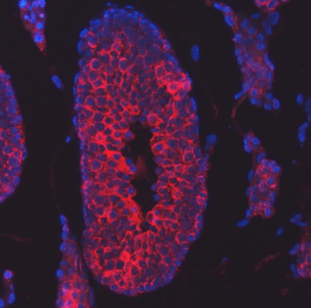 TTLL2 Antibody