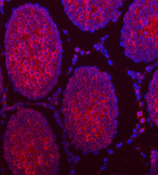 TTLL2 Antibody
