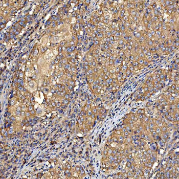 TTLL2 Antibody