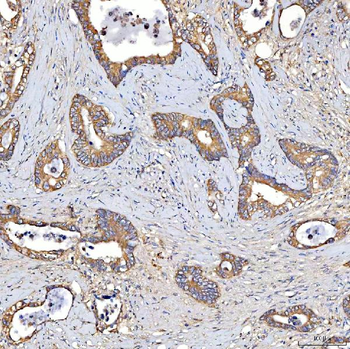 TTLL2 Antibody