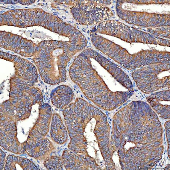 TTLL2 Antibody