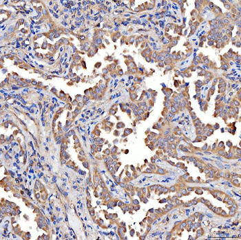 TTLL2 Antibody