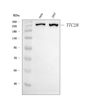 TPRBK/TTC28 Antibody