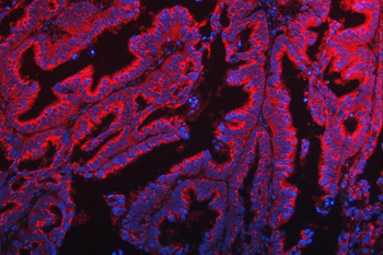 TTC7B Antibody