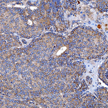 TTC7B Antibody