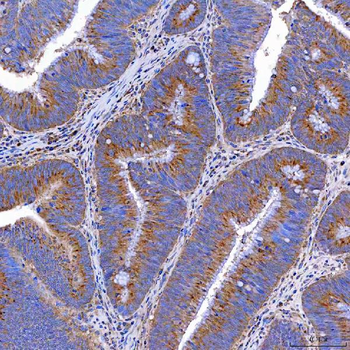 TTC7B Antibody