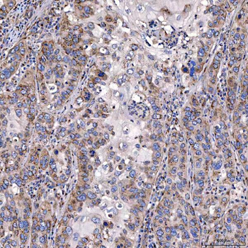 TTC7B Antibody