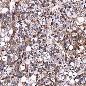 TTC7B Antibody