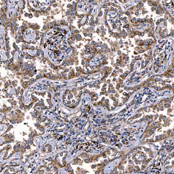 TTC7B Antibody