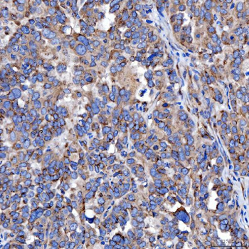 TTC7B Antibody