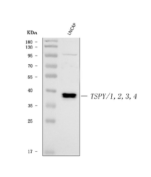 TSPY1/2/3/4 Rabbit Polyclonal Antibody