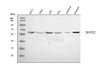 TROVE2/SS-A/RO60/SS Rabbit Polyclonal Antibody