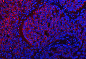 TRMT2B Rabbit Polyclonal Antibody