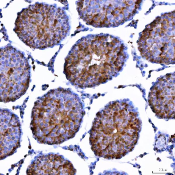 LIN41/TRIM71 Antibody