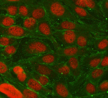 TRIM36 Rabbit Polyclonal Antibody