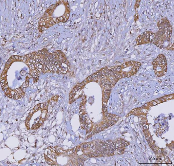 TRIM16 Rabbit Polyclonal Antibody