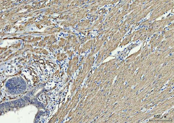 TP53I13 Antibody
