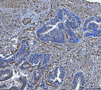 TP53I13 Antibody