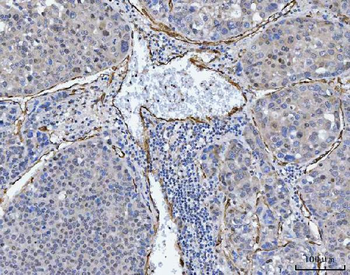 TP53I13 Antibody