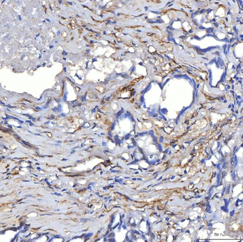 TP53I13 Antibody