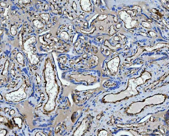TP53I13 Antibody