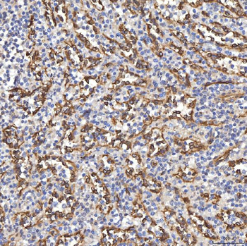 TP53I13 Antibody
