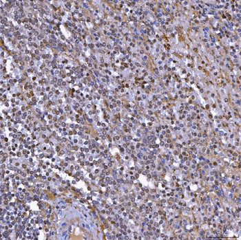 TOP3B Rabbit Polyclonal Antibody