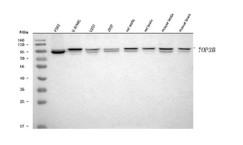 TOP3B Rabbit Polyclonal Antibody