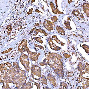 TOMM34 Antibody