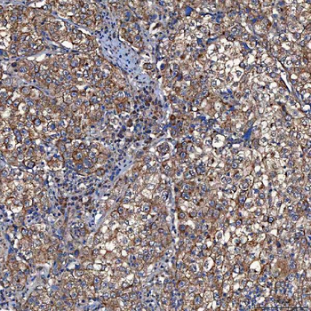 TOMM34 Antibody