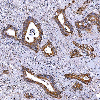 TOMM34 Antibody