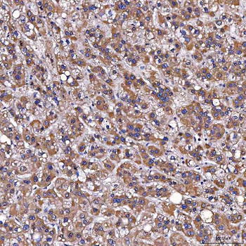 TOMM34 Antibody