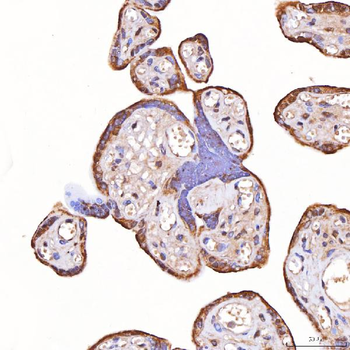 TOMM34 Antibody