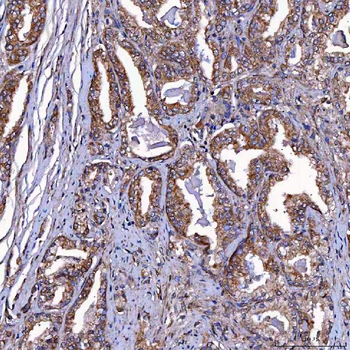 TOMM34 Antibody