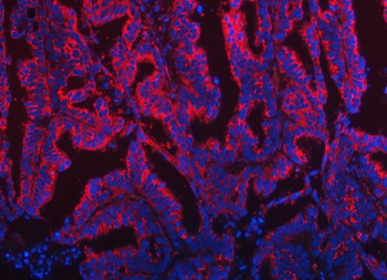 TOM1L1 Antibody