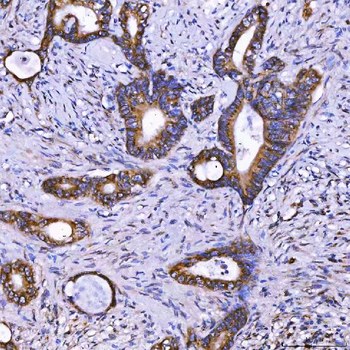 TOM1L1 Antibody
