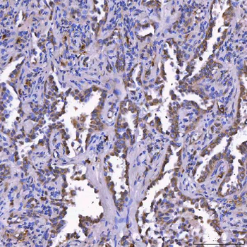 TOM1L1 Antibody