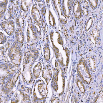 TOM1L1 Antibody